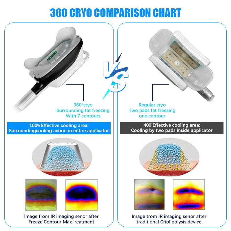 360 Fat Freezing Machine Cryo Slimming 40k Cavitation Cellulite Reduction Radio Frequency Lipolaser Machine Fat Cryo Machine
