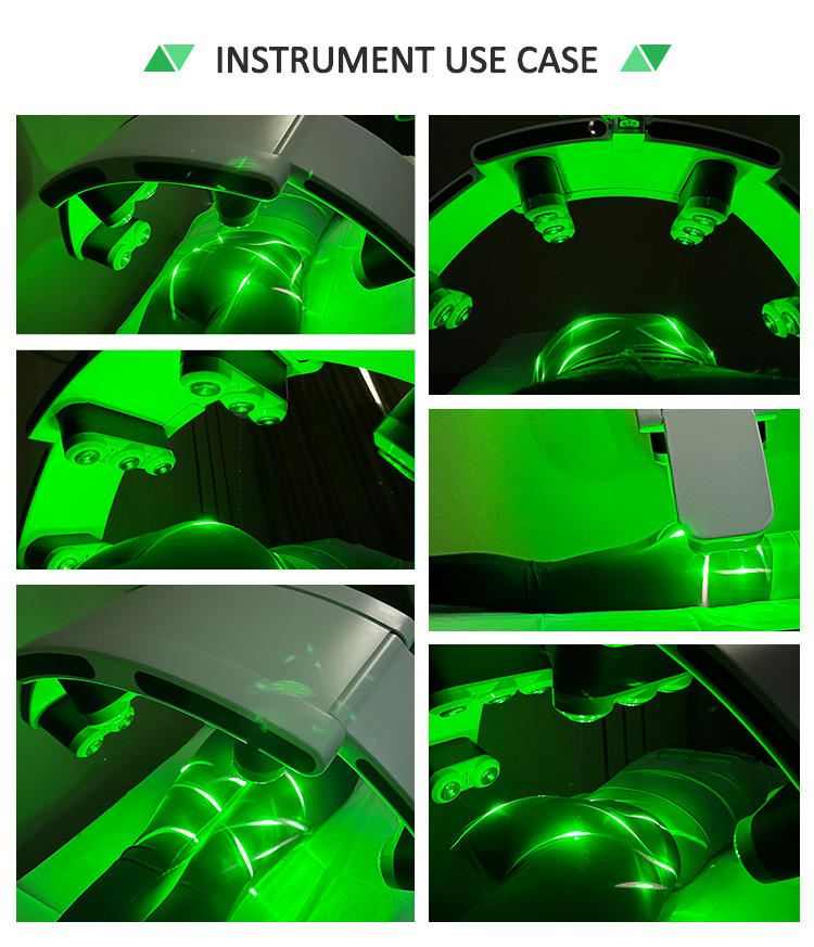 10D Laser Weight Loss Slimming Machine 10D 532 635 Green Light Max Lipo Laser for Master Pain Relief Beauty Personal Care