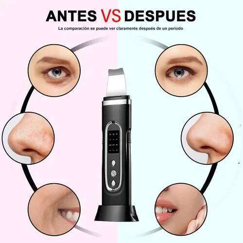Ultrasonic Facial Spatula Blackhead Remover Deep Pore Cleaner Ion Vibration Acne Treatment Skin Lifting Exfoliation Multifunctio