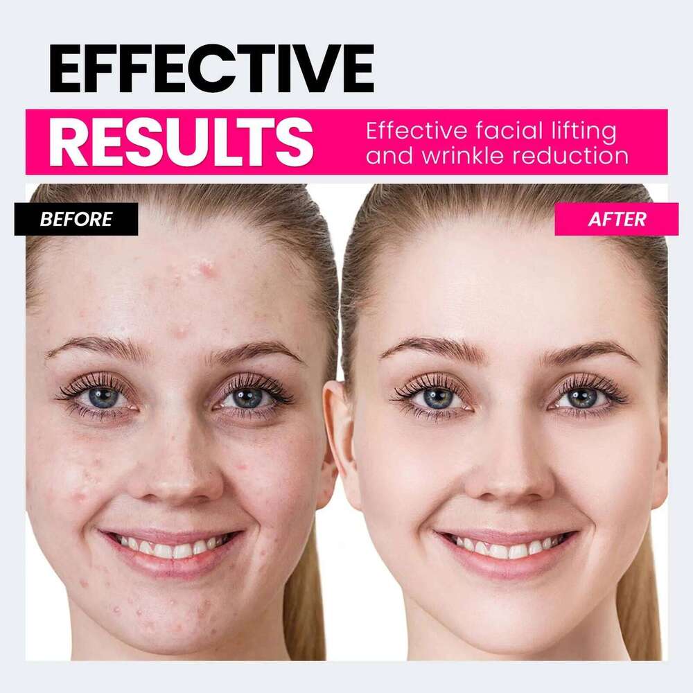 Face Device, USB Microcurrent Shaping Tool For Facial Wrinkle Removal And Anti-Aging