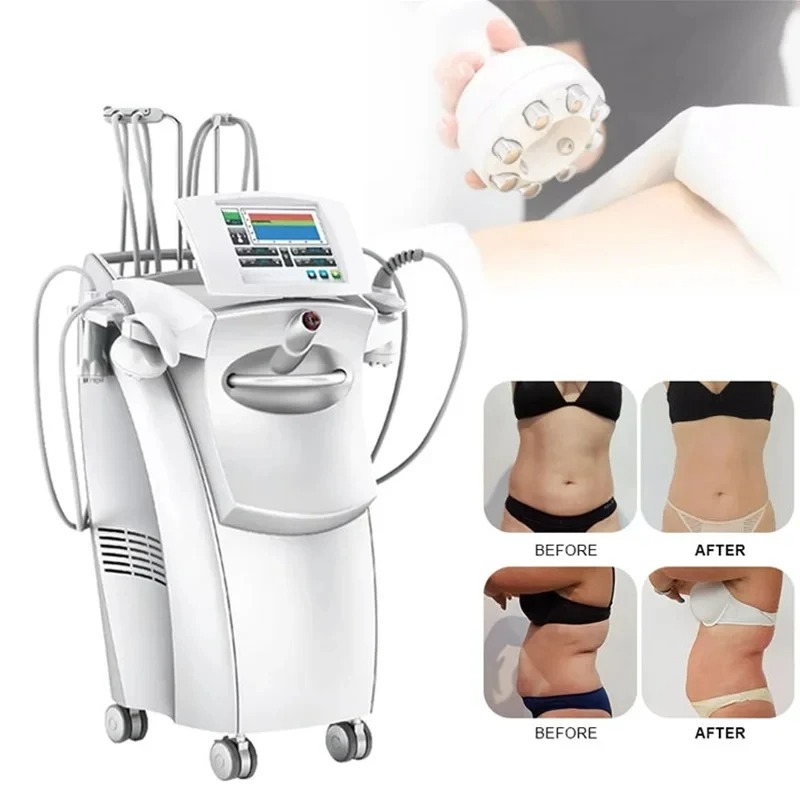 Venus Legacy RF Lifting And Slimming Beauty Device For Skin Rejuvenation Cellulite Removal Fat Dissolving And Wrinkle Reduction For Salon