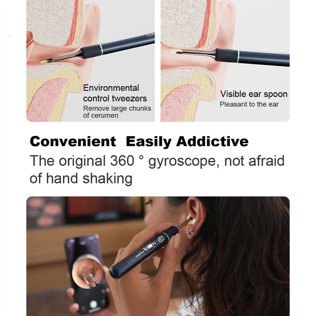 Bebird Note5 Smart Visual Sticks Endoscope Tweezers High Precision Earpick Mini Camera Otoscope Health Care Ear Cleaner