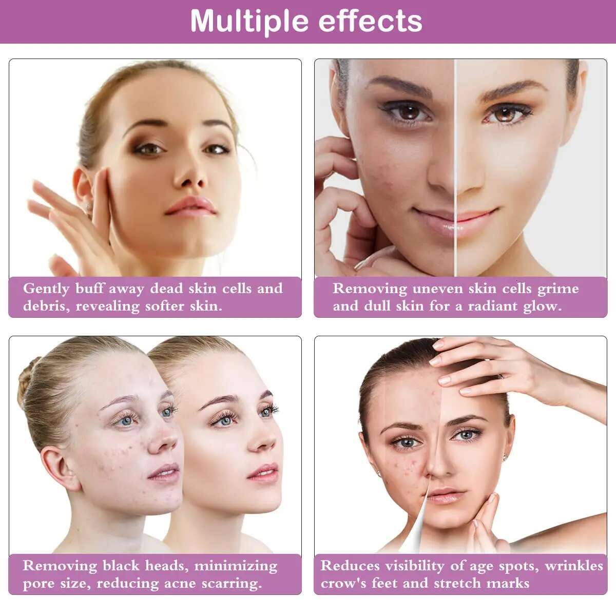 Dia Microdermabrasion hine 65-68cmHg Suction Power Professional Dermabrasion ome Use Facial Skin Care Equipment