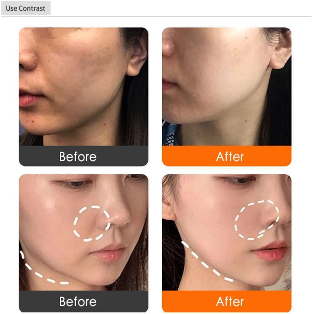 Facial Lifting Remove Wrinkles Dot Matrix Hine Face Skin Tightening Beauty Device Shrink Pores Tools US EU