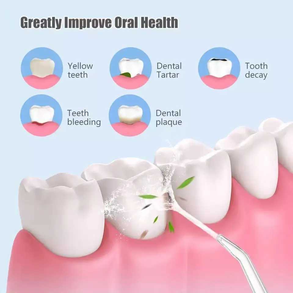 Oral irrigator+4 Jets 3-mode USB charging sink portable dental sink nozzle waterproof irrigator M250408