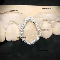Custom Made Personalized Vvs Vvs1 Moissanite Dia Mens Hip Hop 14k White Iced Out Gold Plate Grillz Teeth Decoration