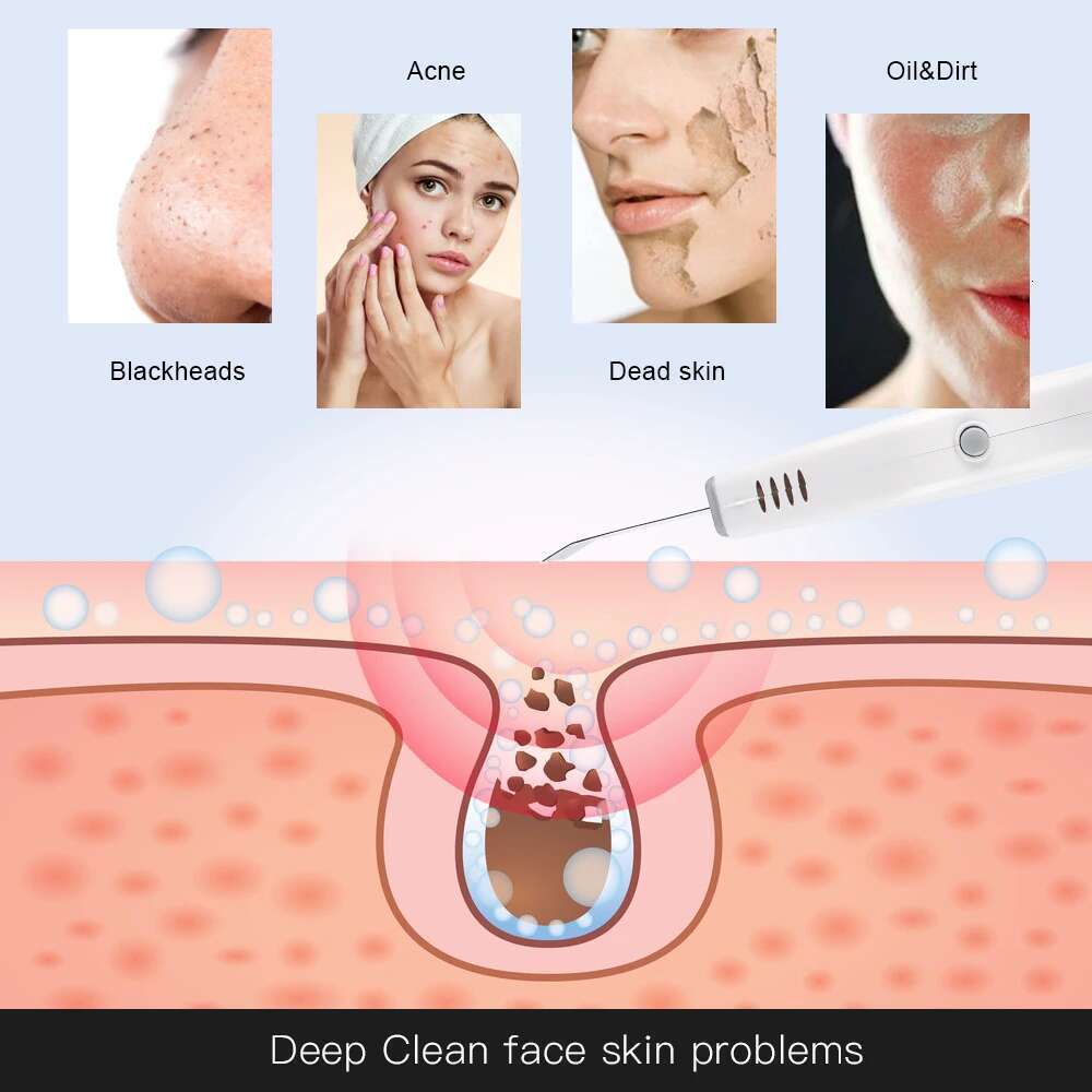Powerful Ultrasonic Facial Scrubber For Deep Cleaning Blackhead Acne Spots Remover Home Used Beauty Tool Skin Care Device
