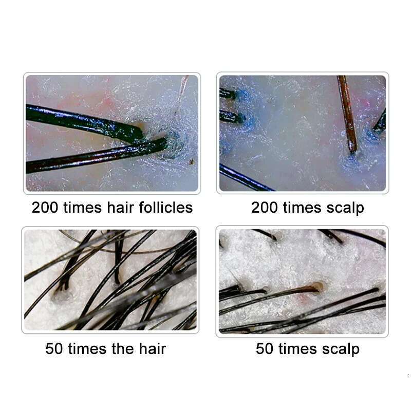 10 Inch LCD Scalp Detector Digital Analyzer Microscope For Hair Follicle Testing And Skin Analysis Magnifier 50/200X