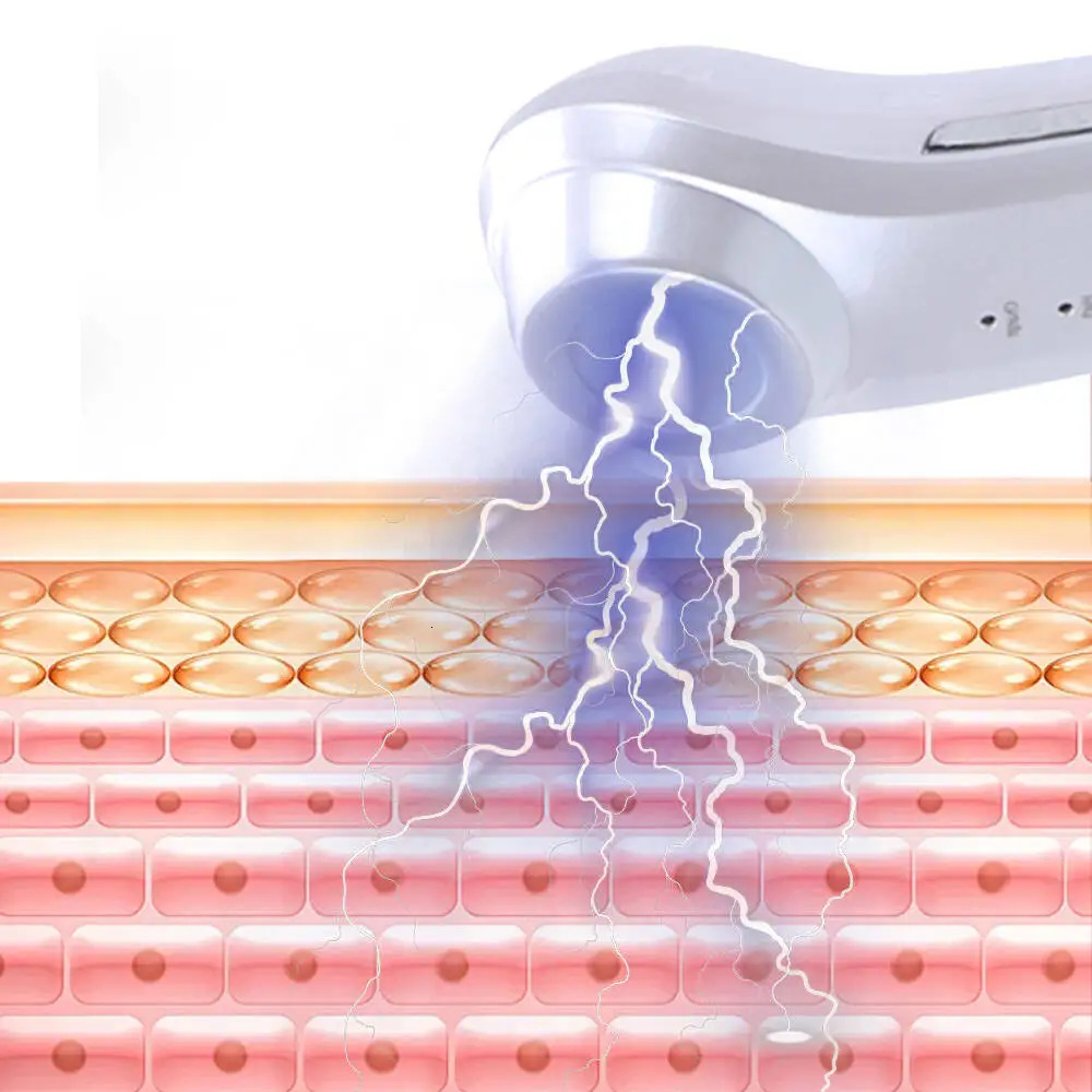 Professional Skin Care And Beauty Instrument Plasma Acne Wand Anti Aging Wrinkle SPA Salon Household 251106