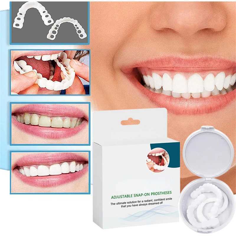 New Arrival Adjustable braces perfectly fit teeth whitening buckles silicone portable braces decorative gaps smile stickers Z250410