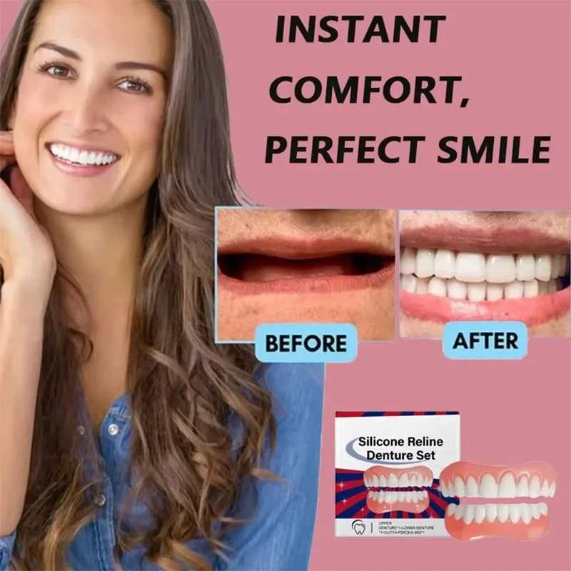 Adjustable silicone dental professional dental kit with smile and soft and comfortable Korean dental adhesive for upper and lower veneers M250410