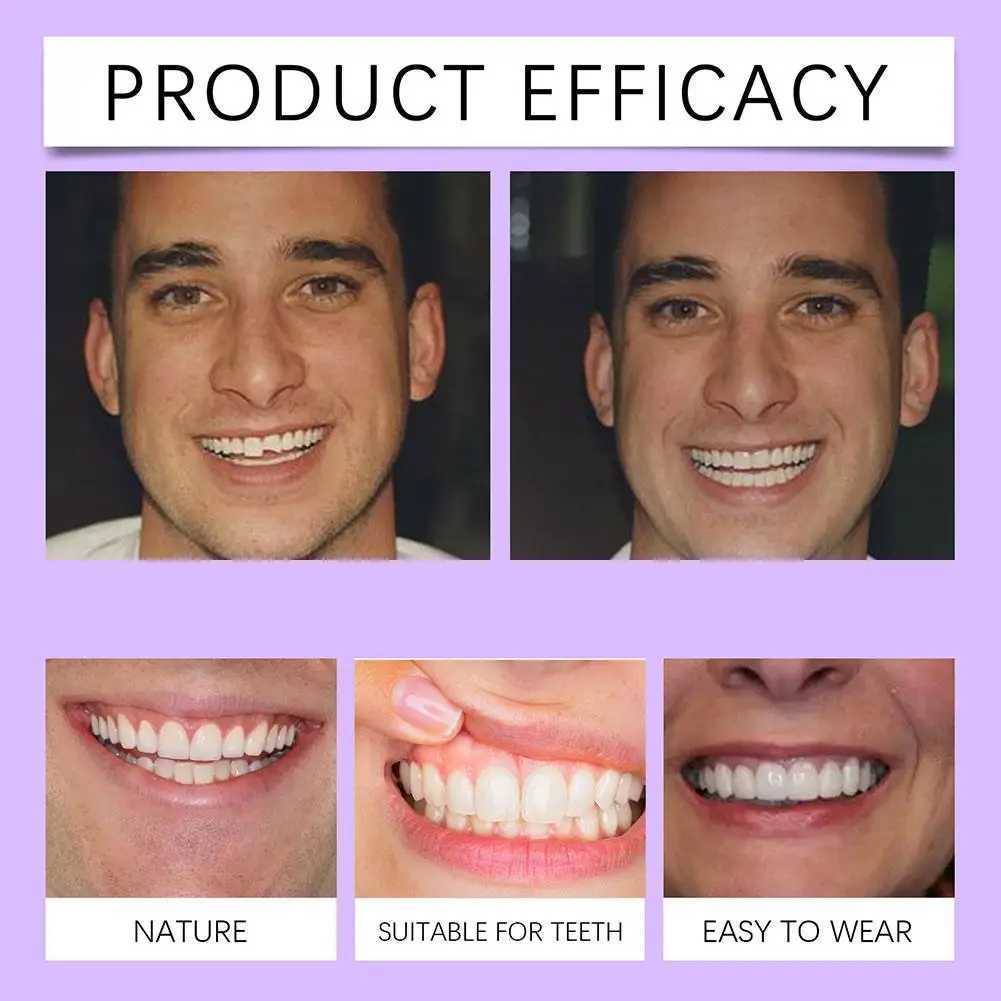 Professional orthodontic bracket comfortable and adjustable with a long lifespan. Dental kit for filling gaps M250410
