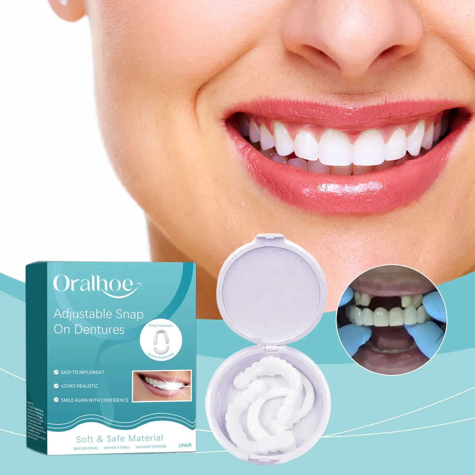 New Arrival Adjustable Dental Bracket for Snap on Dentures Portable Bracket for Decorative Gap of Adjustable Silicone Teeth Z250410