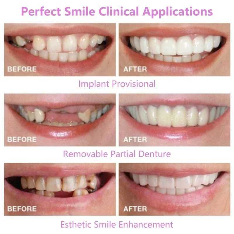 2 pieces/set of silicone whitening cover brackets for upper and lower teeth simulating teeth with smile box M250410