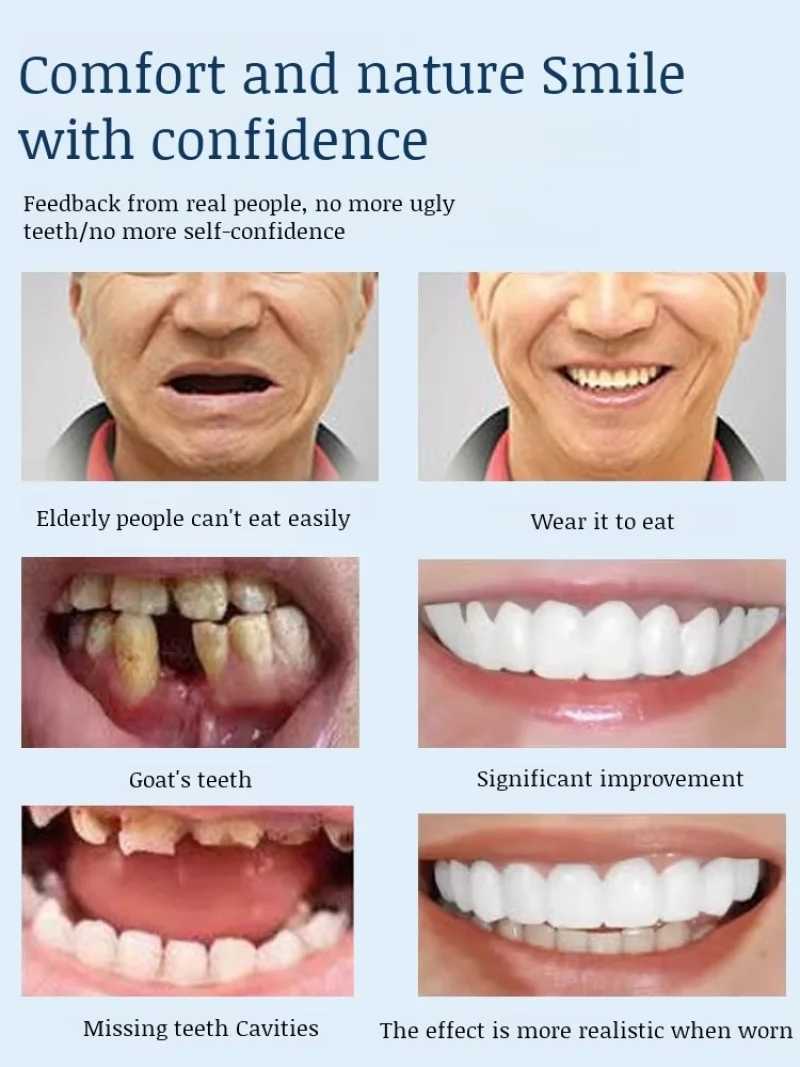 Adjustable buckle style comfortable teeth can be adjusted to fit the shape of the mouth and make the teeth fit the teeth to accommodate the constantly