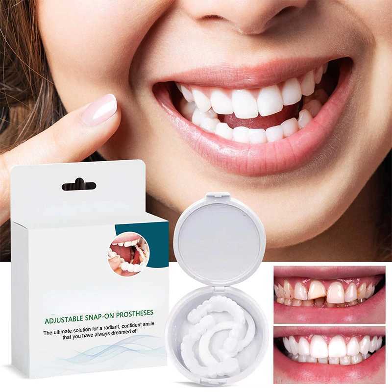 New Arrival Adjustable braces perfectly fit teeth whitening buckles silicone portable braces decorative gaps smile stickers Z250410