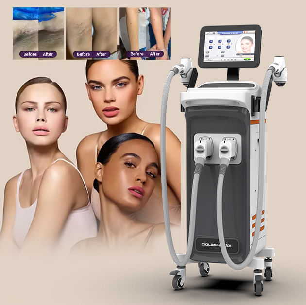 Removable Hair Removal Device 4 Wavelengths 755nm 808nm 940nm 1064nm Dual Handle Diode Laser Machine for Hair Removal