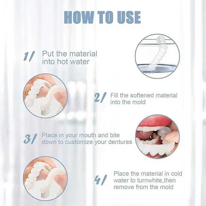 New Arrival Veneer button kit denture cover button denture simulation bracket veneer denture cosmetic denture cover Z250410