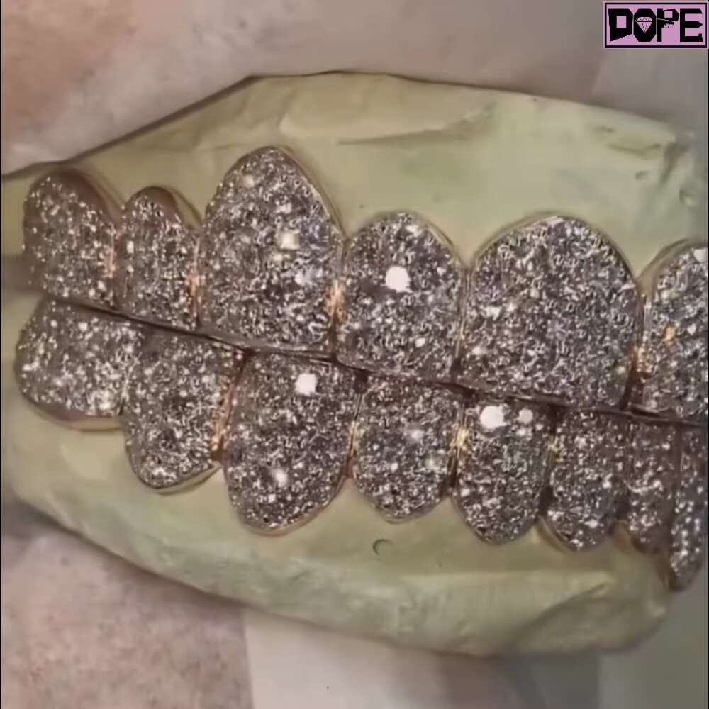 Customized 16 Teeth Iced Out Grillz 14kt White Gold Men Women 925 Silver D VVS Moissanite Grillz
