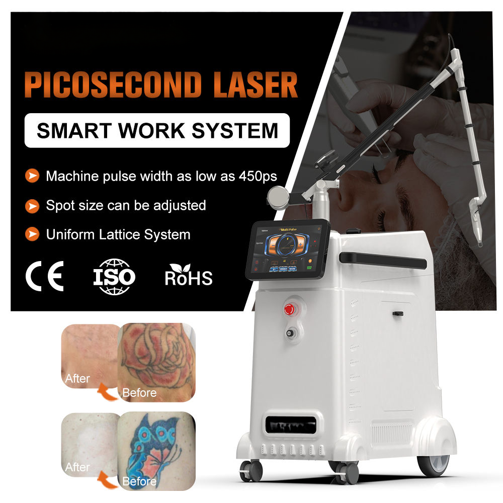 Newest Design 1-10Hz Adjustable Picosecond Q-switch Nd Yag Laser Tattoo Removal Equipment for beauty salon