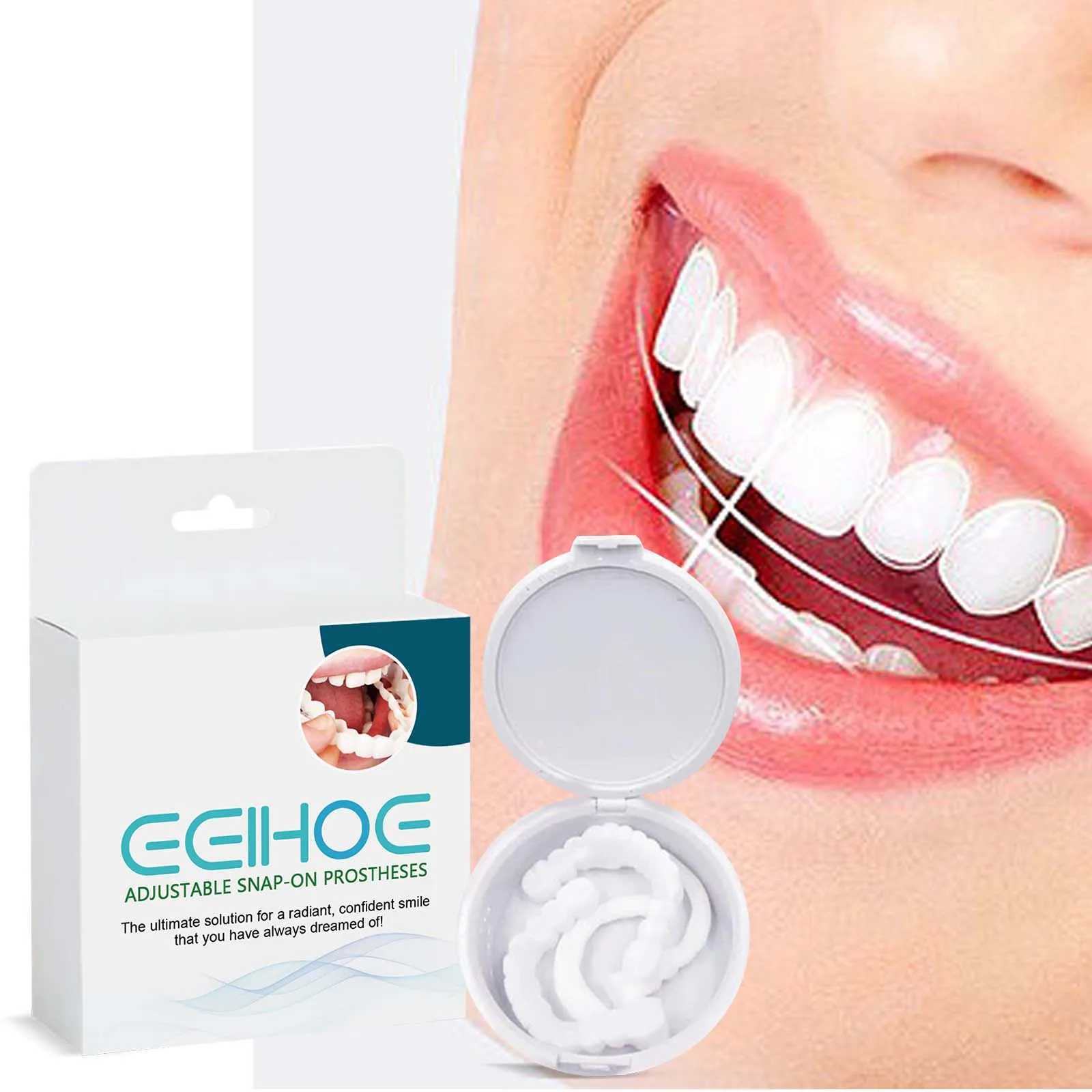 Adjustable braces for smiling veneers natural and portable brackets decorative gaps used to enhance dental aesthetics M250410