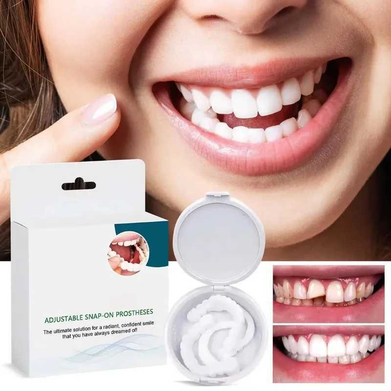 By 2025 adult adjustable braces with adjustable buckles for dentures and portable brackets will be used to decorate gaps and enhance dental aesthetics