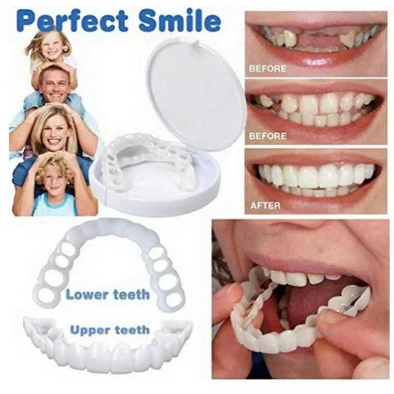 New Arrival Veneer clasps perfectly fit the dental cap clasps silicone smile whitening dentures veneer teeth cosmetic tools dental Z250410