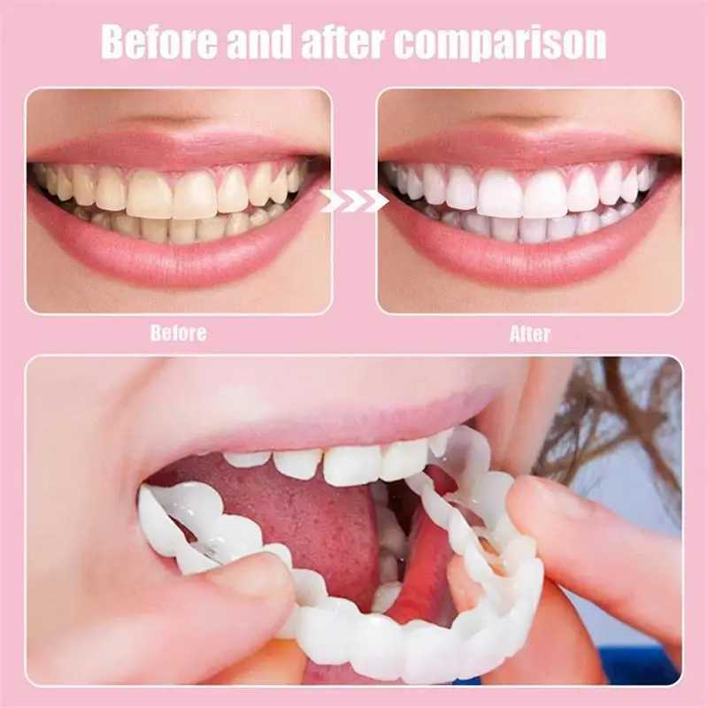 Tooth veneer tooth cover tooth veneer set tooth veneer stuck on the cover dentures instantly confident smile temporary teeth M250410