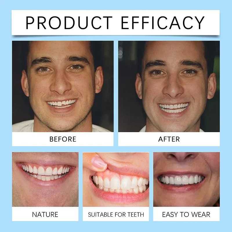 New Arrival Orthodontic dental cosmetics dental filling gaps upper and lower false veneers replacement of missing teeth cosmetic kit Z250410