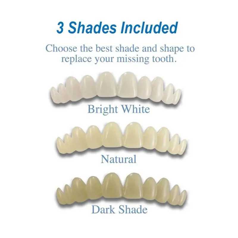1 set of temporary dental restoration kit upper and lower denture veneers dental brackets denture clasps restoration accessories materials M250410