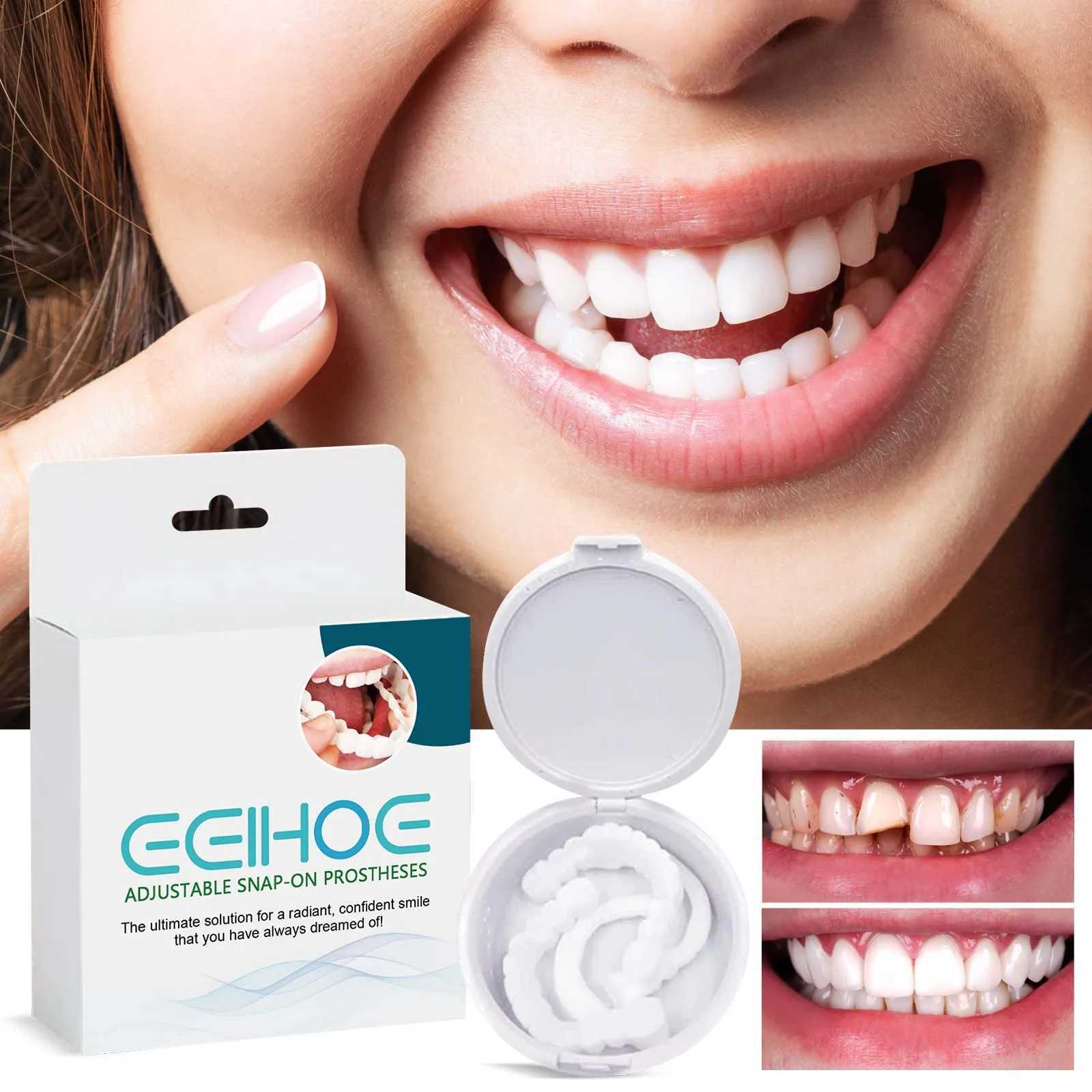 New Arrival Adjustable teeth set instant smile veneer teeth whitening natural portable bracket decorative gap between teeth Z250409