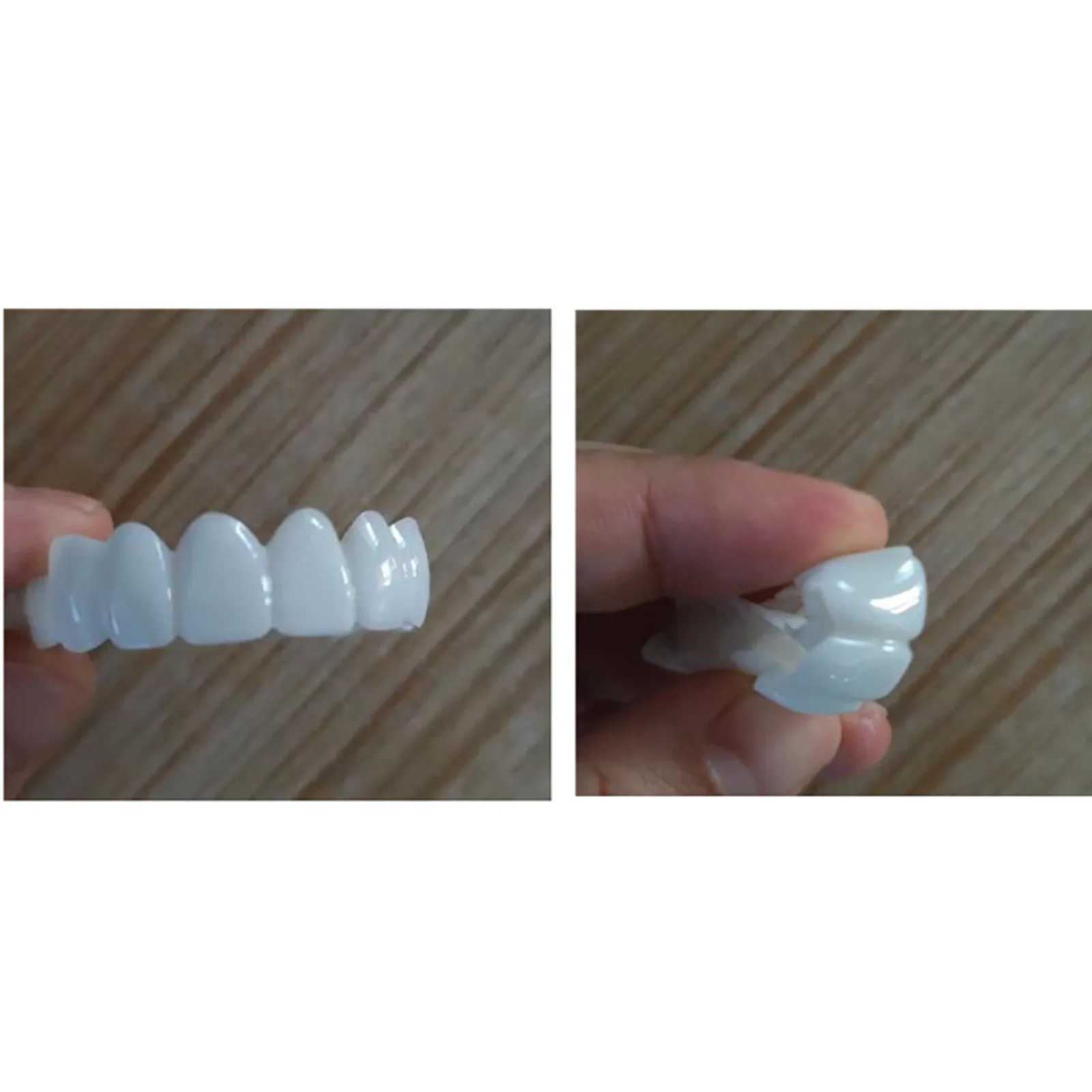 SowSmile Silicone smile Dental Hygiene Upper and Lower Dentures Cover Veneer Tooth Support Whitening Product Mold M250410
