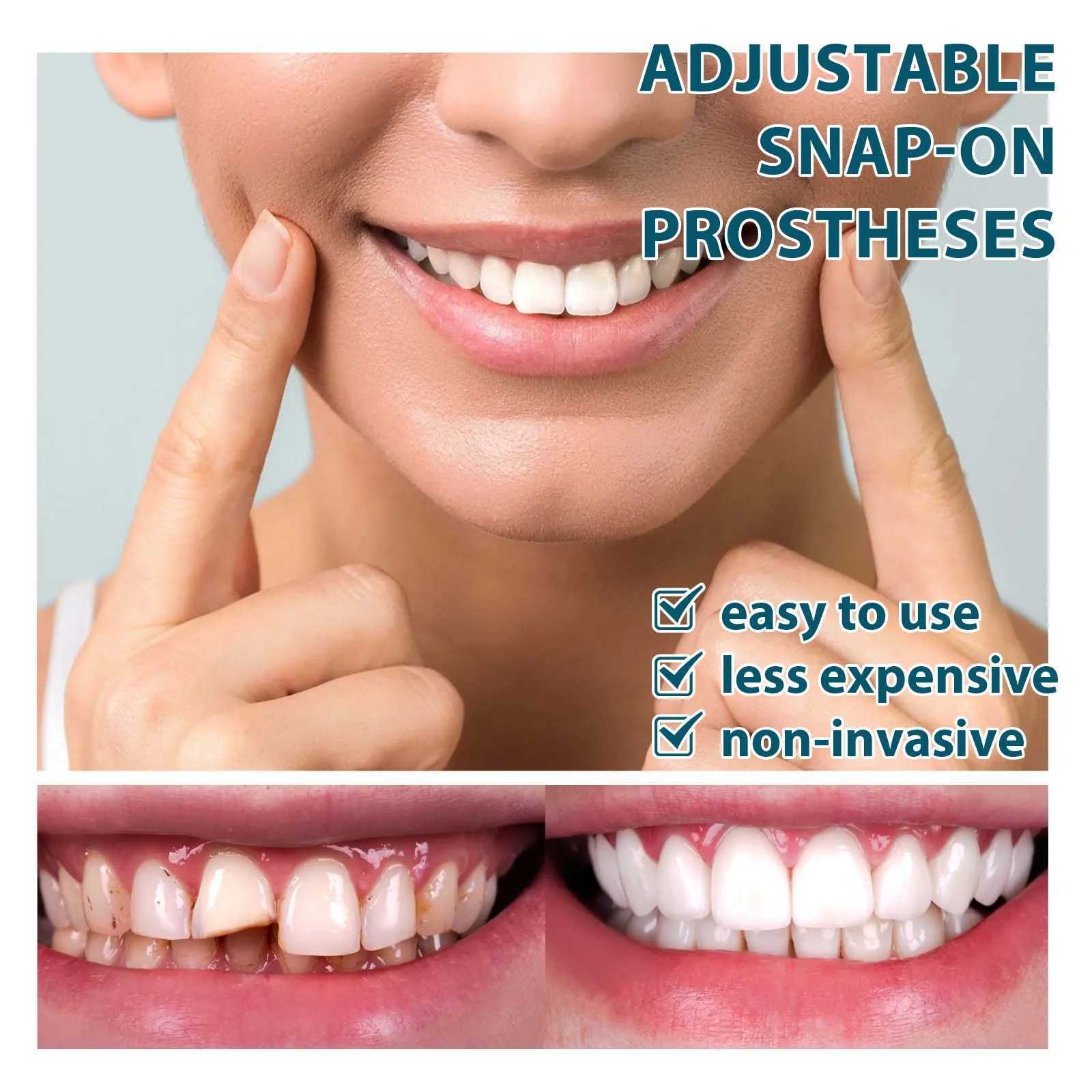 Eelhoe 1 pair adjustable teeth set whitening teeth temporary smile oral hygiene care teeth veneer false teeth set M250410