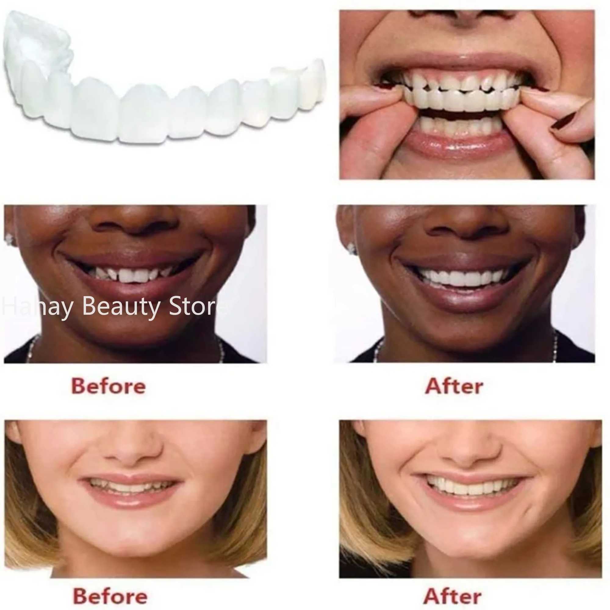 New Arrival Upper and lower teeth silicone teeth whitening teeth cover teeth bracket simulates teeth with Smile box Z250410