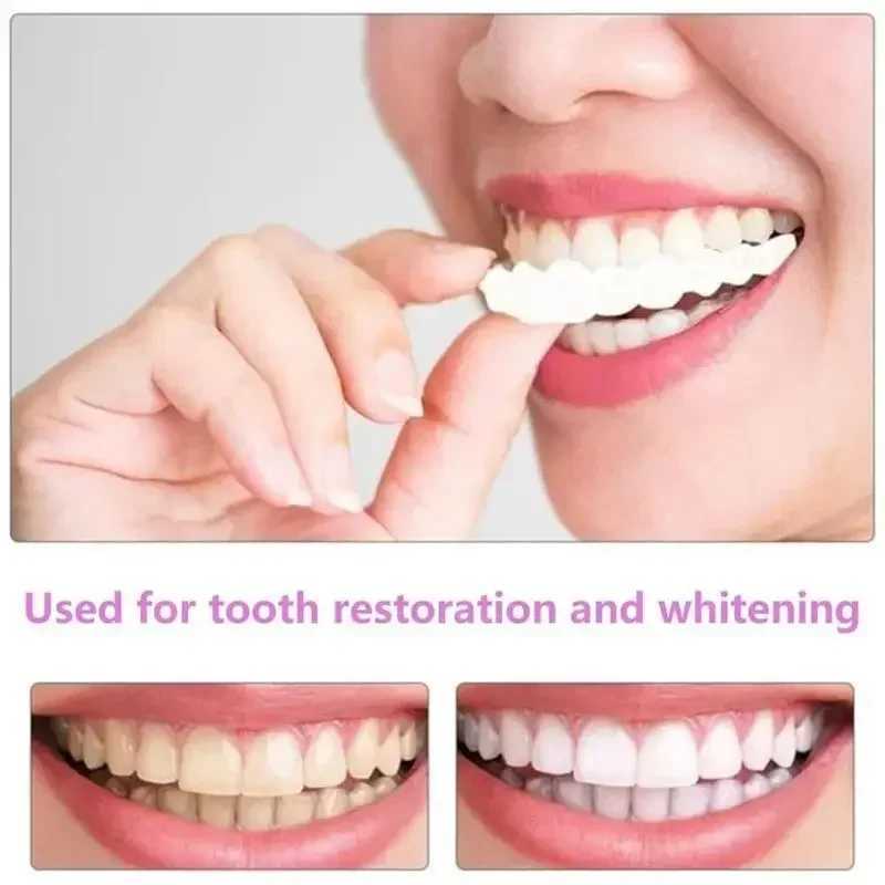 Adult Adjustable Braces Adjustable Buckles Dentures Portable Bracket Oral Hygiene Care Decorative Gap M250410
