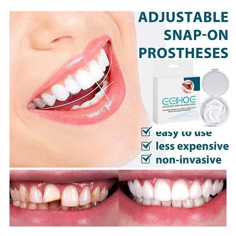Adjustable natural teeth set instant smile veneer teeth whitening portable bracket decorative gap between teeth M250410