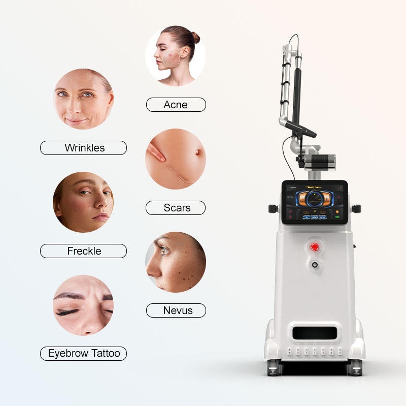 Picosecond Laser Tattoo Removal Machine: Painless Spot Erasing + Black Face Doll Skin Regeneration