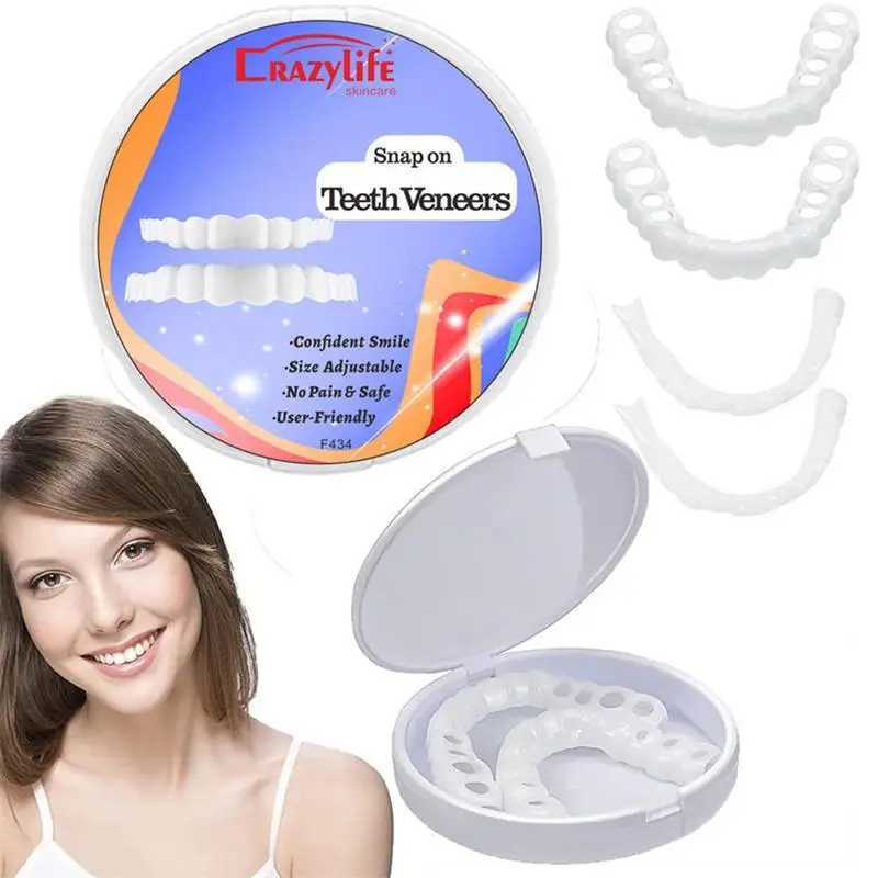 New Arrival Veneer clasps perfectly fit the dental cap clasps silicone smile whitening dentures veneer teeth cosmetic tools dental Z250410