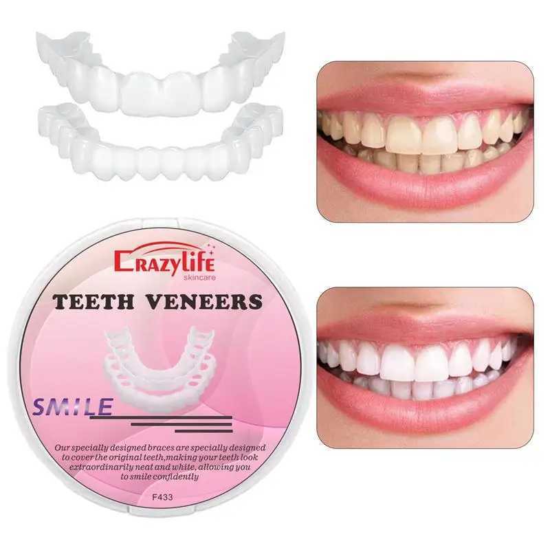 New Arrival Tooth veneer tooth cover tooth veneer set tooth veneer stuck on the cover dentures instantly confident smile temporary teeth Z250410