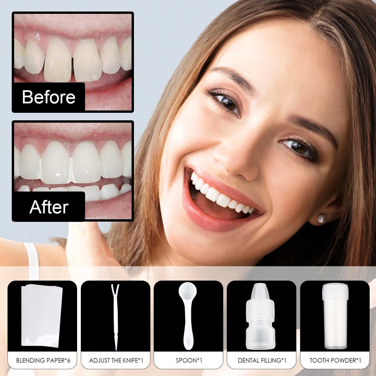 Shape Gutta percha set easy to install durable does not fall off fills tooth gaps tooth bonding repair kit M250410