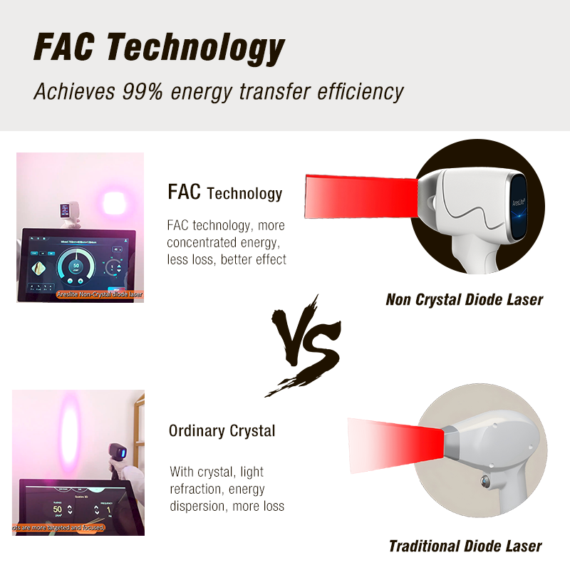 Winkonlaser 4 Wavelengths Laser Diode 808nm 755 940 1064NM Laser Beauty Equipment For Hair Removal