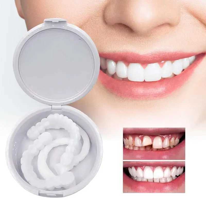 Veneer button kit denture cover button denture simulation bracket veneer denture cosmetic denture cover M250410