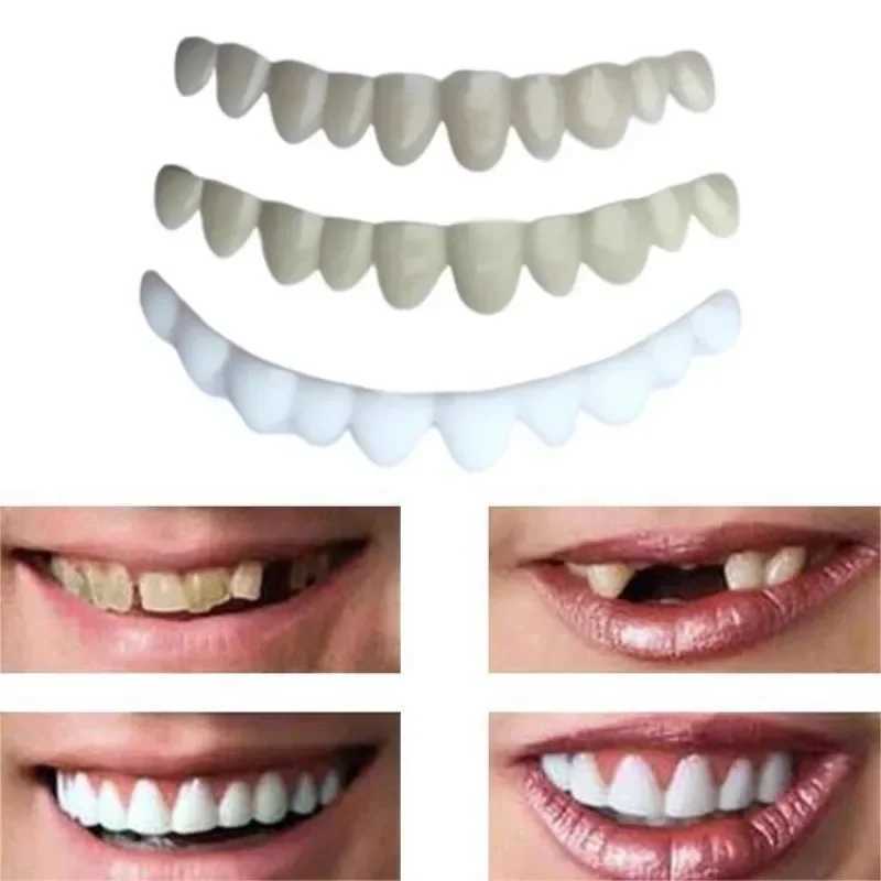 The new type of denture patch is faced with a flexible and comfortable upper and lower buckle bracket which fits snugly with the filling material for 