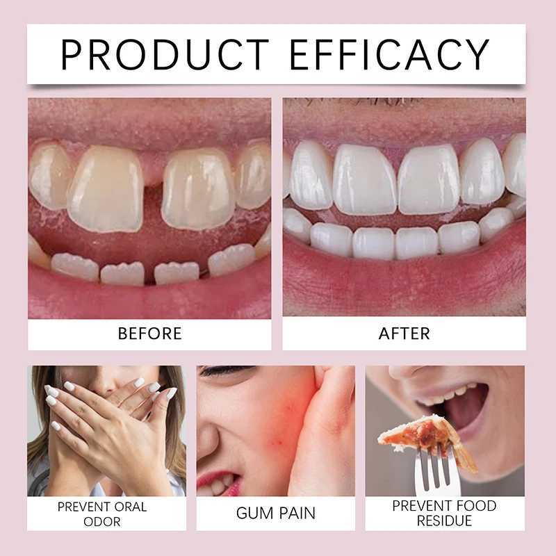 New Arrival Silicone denture orthodontic kit suitable for temporary orthodontic teeth improvement smile comfort teeth oral hygiene care Z250410