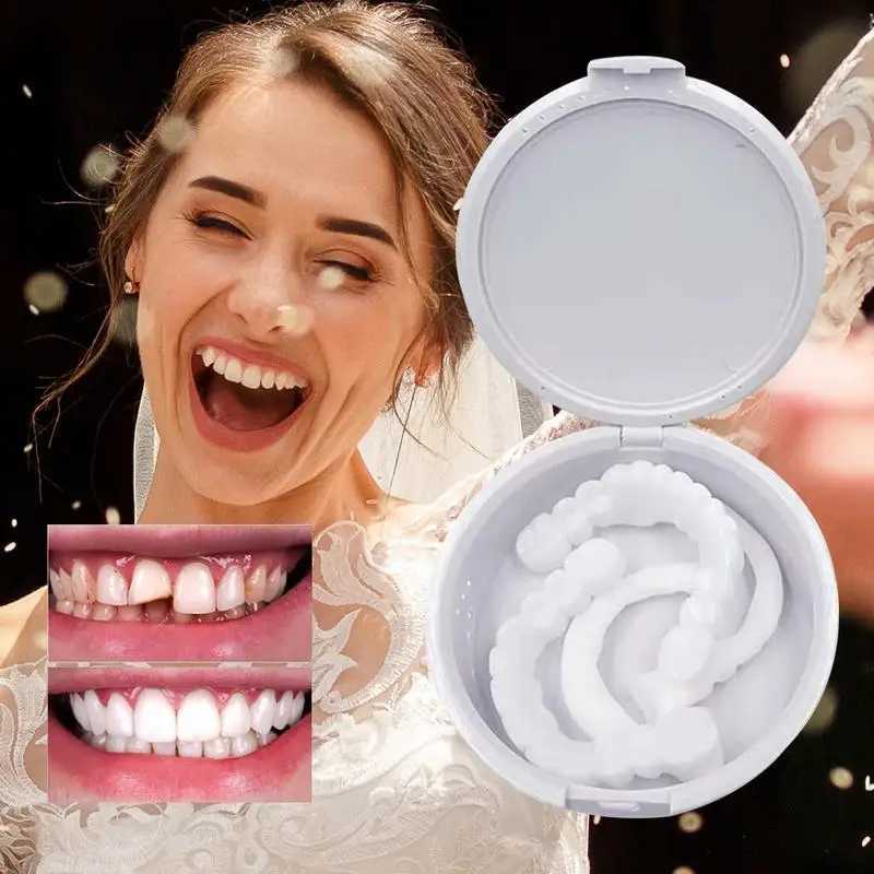 Veneer button kit denture cover button denture simulation bracket veneer denture cosmetic denture cover M250410