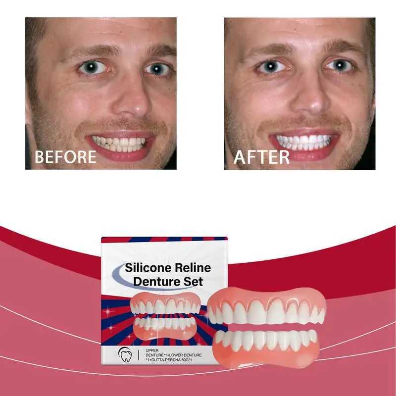 Silicone denture set with silicone upper and lower veneers laughing soft denture set with silicone lining soft denture set M250410