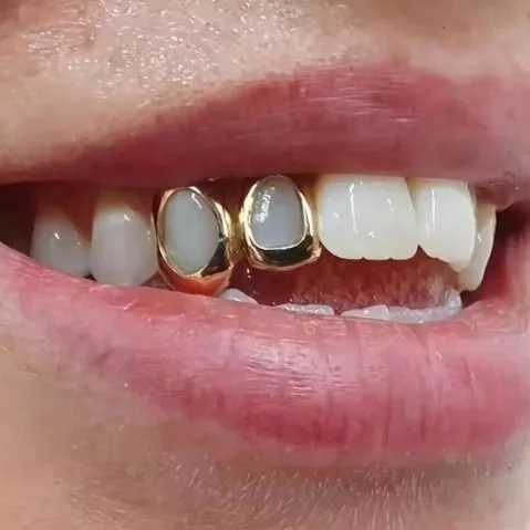 Hip Hop Hollow Heart Teeth Grillz Womens Gold Everyday Wearable Teeth Jewelry Teeth Grillz W250412