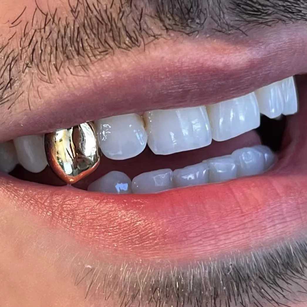 YONGX Hip Hop Classic Single Tooth Grillz Simple 14K Gold Plated Smooth Tooth Hat Suitable for Women Men Punk Jewelry Party Role Playing W250412