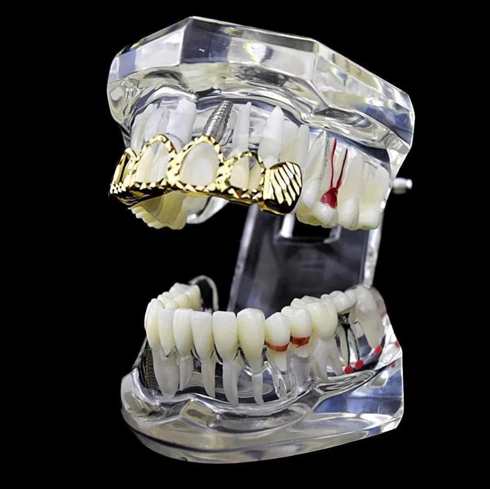 TOPGRILLZ D-Cut Grilz Set Pure Gold Plated Upper and Lower Teeth 4-Open Hip Hop Grill Hollow Teeth Grill Set W250412
