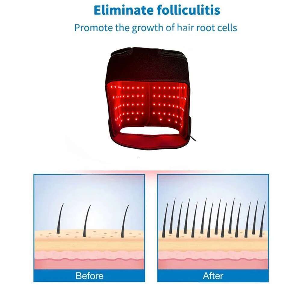 180Pcs Red Regrowth Cap 660Nm&850Nm Near-Infrared Light Reduces Oiess Strengthen Hair Roots Anti-Hair Loss Hat